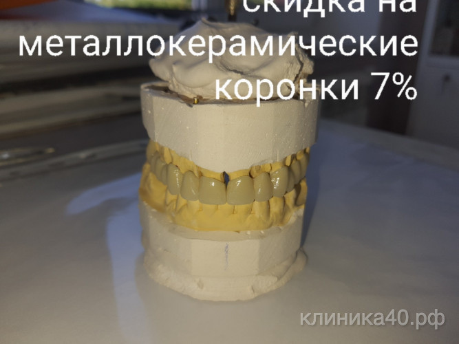 koronka-na-zub